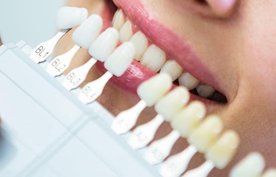 Férulas para el Bruxismo  Dentistas Arganzuela - Ortodoncia e